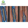 Vein Closure System